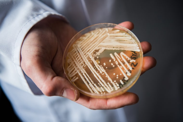 Petri dish of candida auris in a laboratory in Wuerzburg, Germany