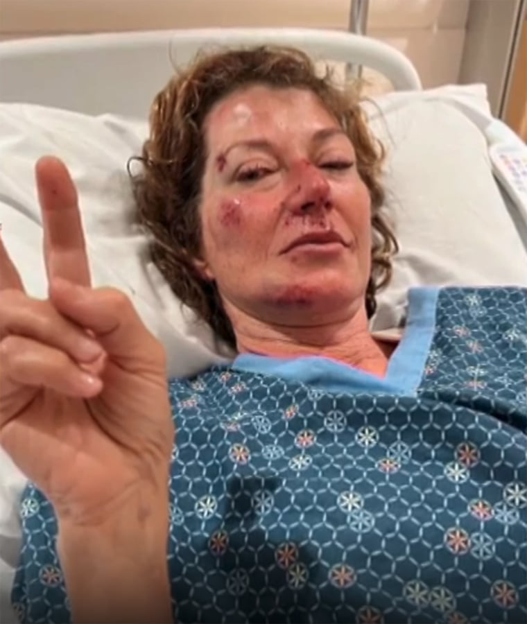 Amy Grant bike crash