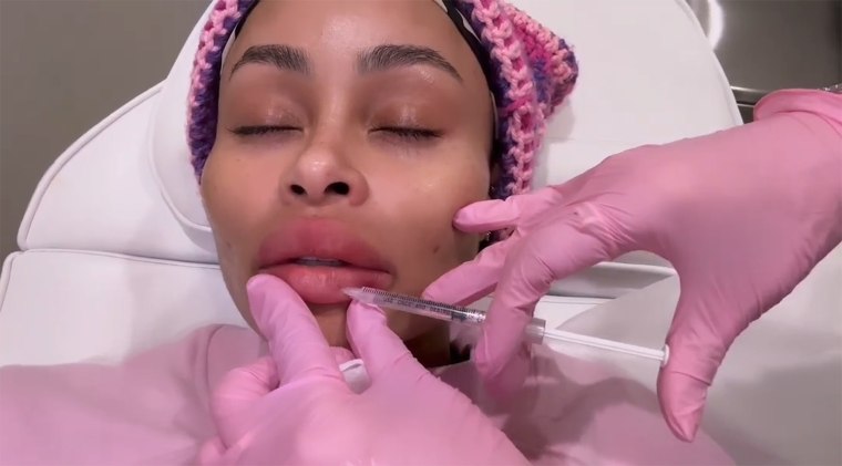 Blac Chyna getting her lip filler removed.