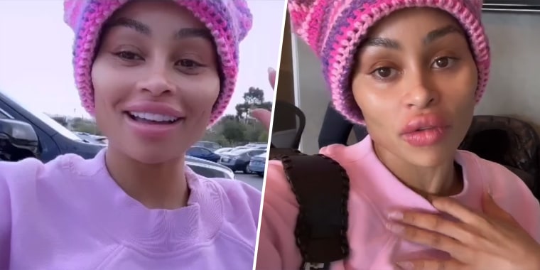 Blac Chyna shows the before and after results of her face filler removal.