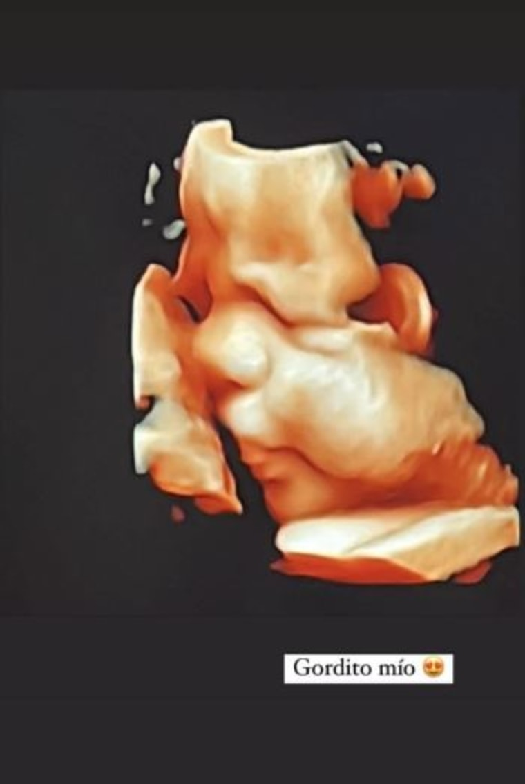 Ximena Navarrete y el ultrasonido 3D de su bebé 