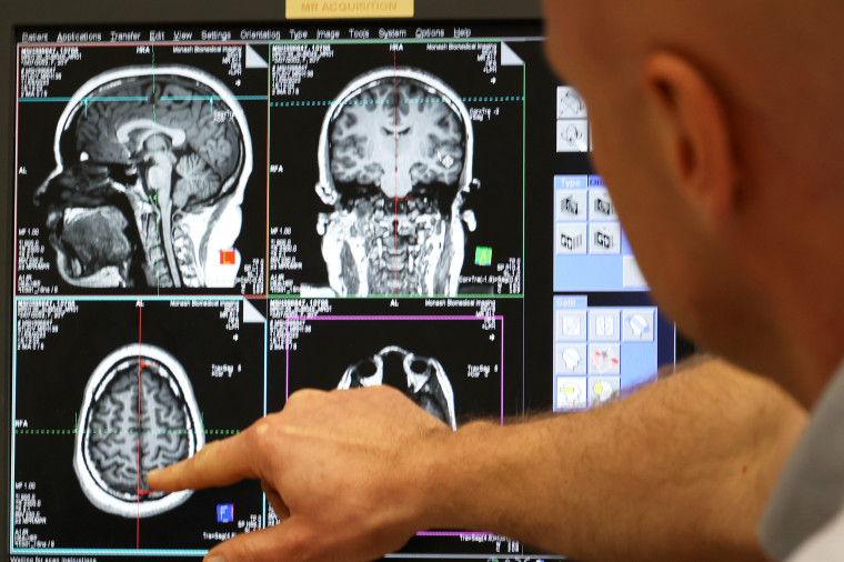 Сканирование мозга в парке мозгов Монаша.<br />
17/5/2023
