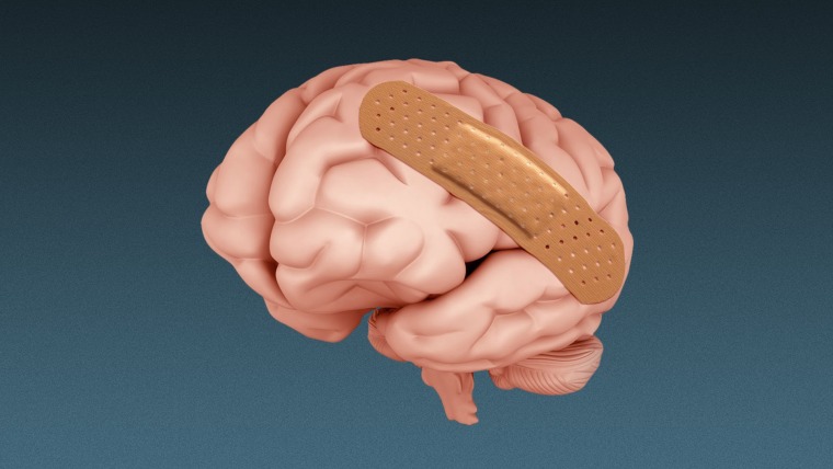Ilustración de un corte lateral de un cerebro que tiene una band-aid o curita, en representación de cuidados de salud mental 
