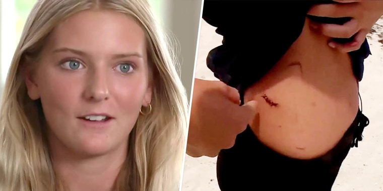 Ella Reed received stitches in her torso and leg after a shark attack in the waters near her Florida home last week.