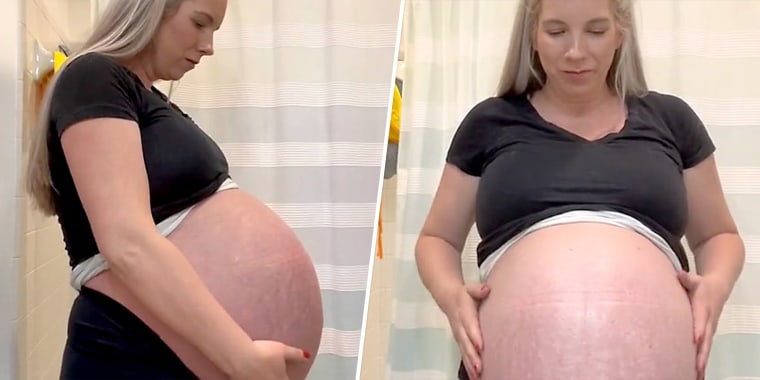 Mom Of Triplets Defends Baby Bump Size From Commenters