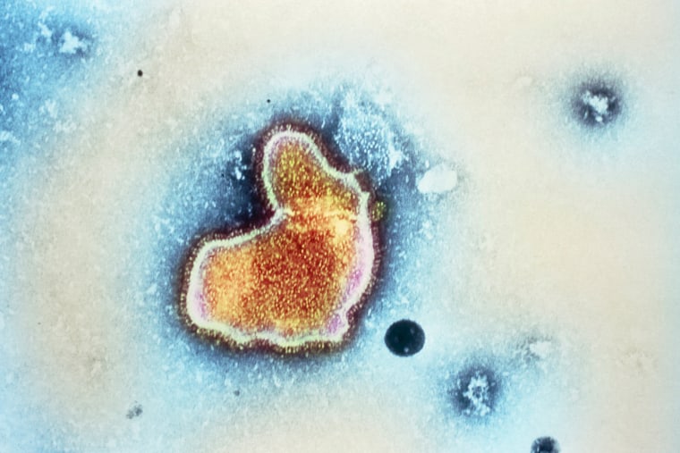 Transmission electron micrograph  of a respiratory syncytial virus (RSV).
