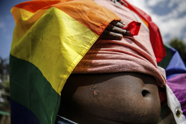 A gay Ugandan refugee shows his scars from an attack on the street in Kenya
