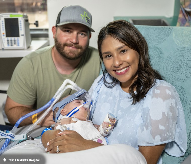 Sandy Fuller said holding her babies on their back after their separation surgery made her feel 'grateful.'