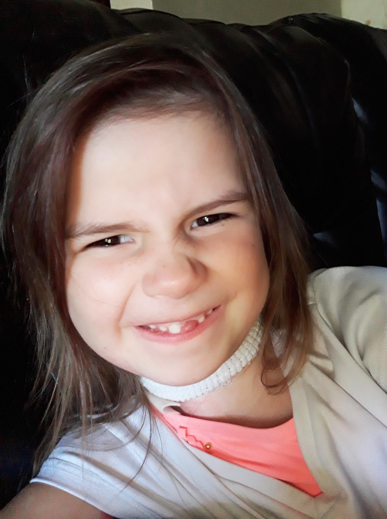 Harlee had to undergo physical therapy to help her be able to move her neck again after sustaining third degree burns to her neck and the right side of her body.