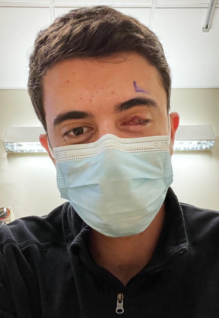 Nick Kharufeh before his surgery.