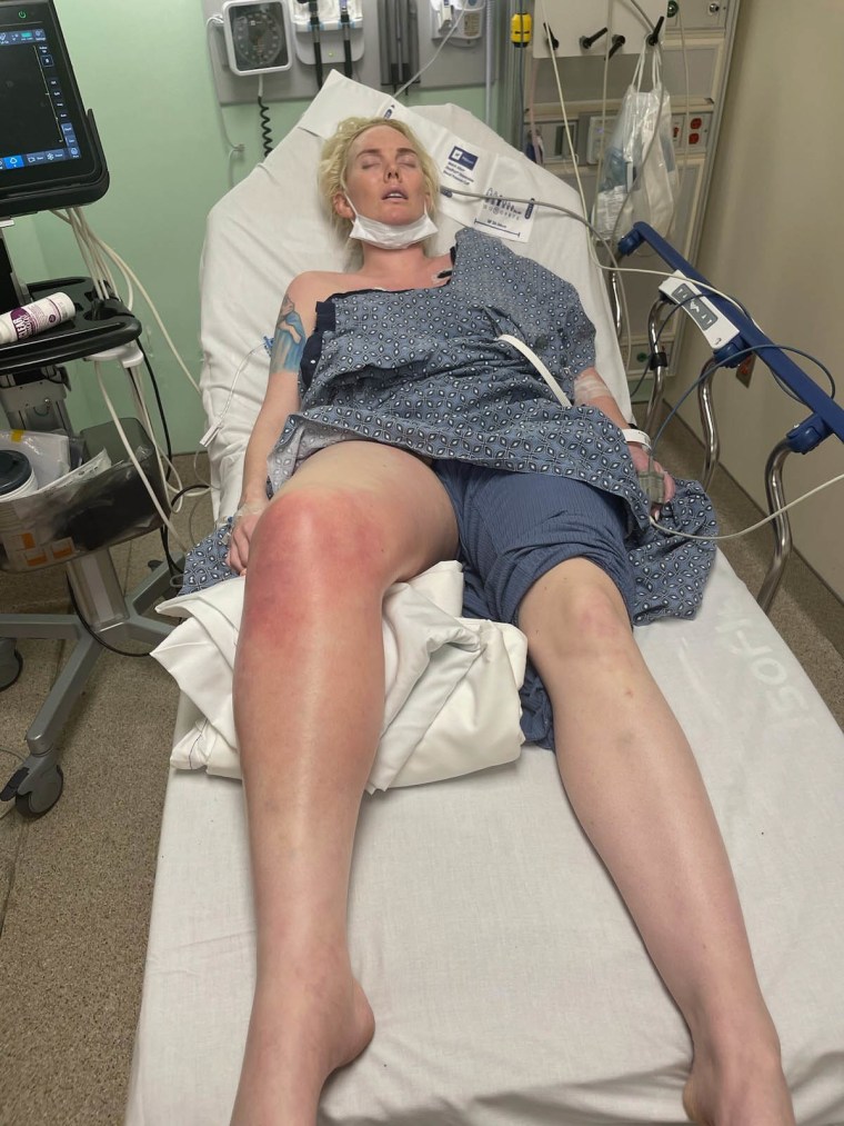 This Woman's 'Electric Shock' Leg Pain Was Caused By a Parasite in Her Back