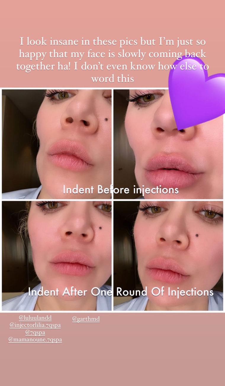 Khloe Kardashian's stitches from scary face surgery revealed in graphic new  unedited video amid cancer scare