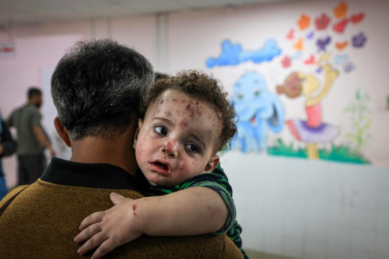 An injured child at the al-Quds hospital in Deir al-Balah, Gaza.