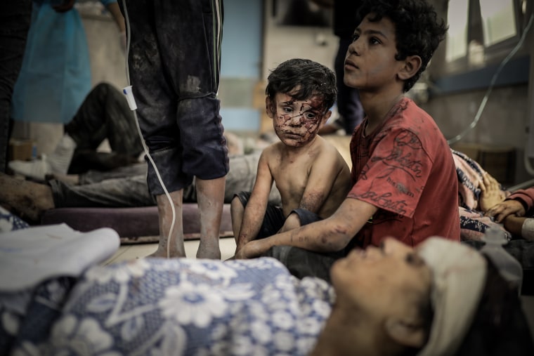 Injured Palestinian children and  adults after Israeli attacks at Al-Shifa Hospital in Gaza City, Gaza on Oct. 23, 2023.