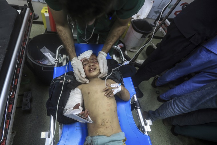 A wounded Palestinian child receives medical attention in Khan Younis in southern Gaza.