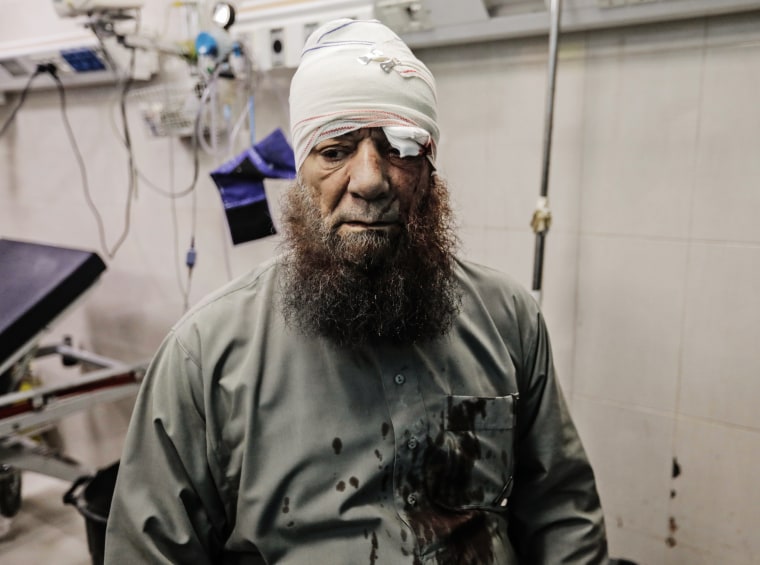 An injured Palestinian man at Nasser Hospital on Nov. 14, 2023  in Khan Younis, Gaza. 