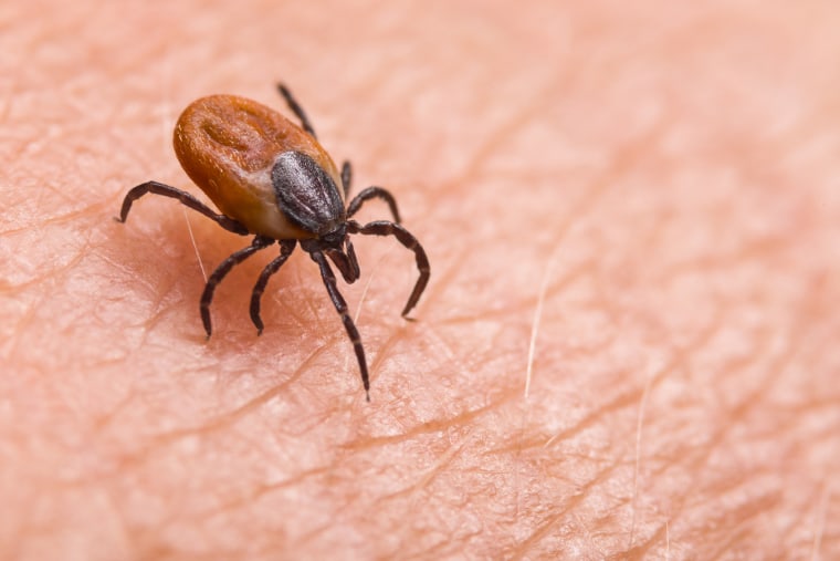 Infected female deer tick on hairy human skin.