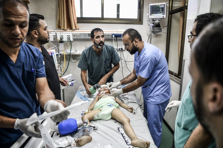 Doctors examine a child injured during an Israeli attack at Nasser Hospital in Khan Yunis, Gaza on Oct. 13, 2023. 