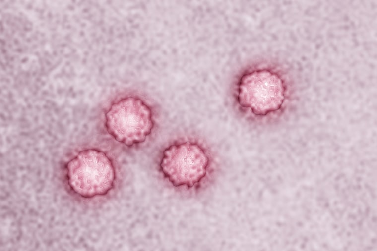 Hepatitis A virus (picornavirus)