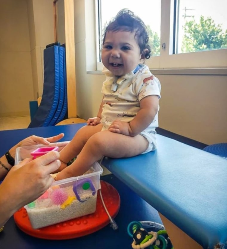 Bebé Nació Con Un Pie En El Cerebro Curan Malformación Cerebral De