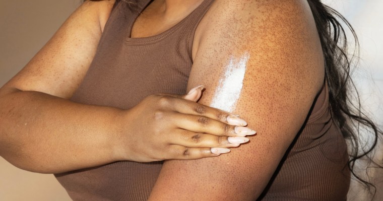 Keratosis pilaris is a very common skin condition that can appear as rough, scaly bumps on the skin, which often flare up during the wintertime or with hormonal fluctuations.