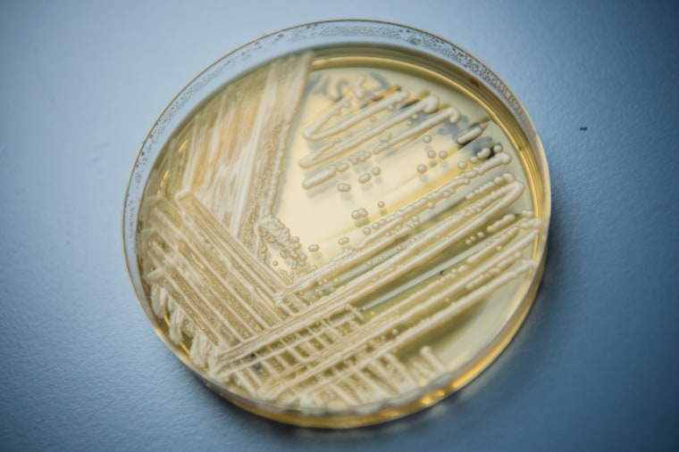 Washington faces first outbreak of Candida auris fungal infections