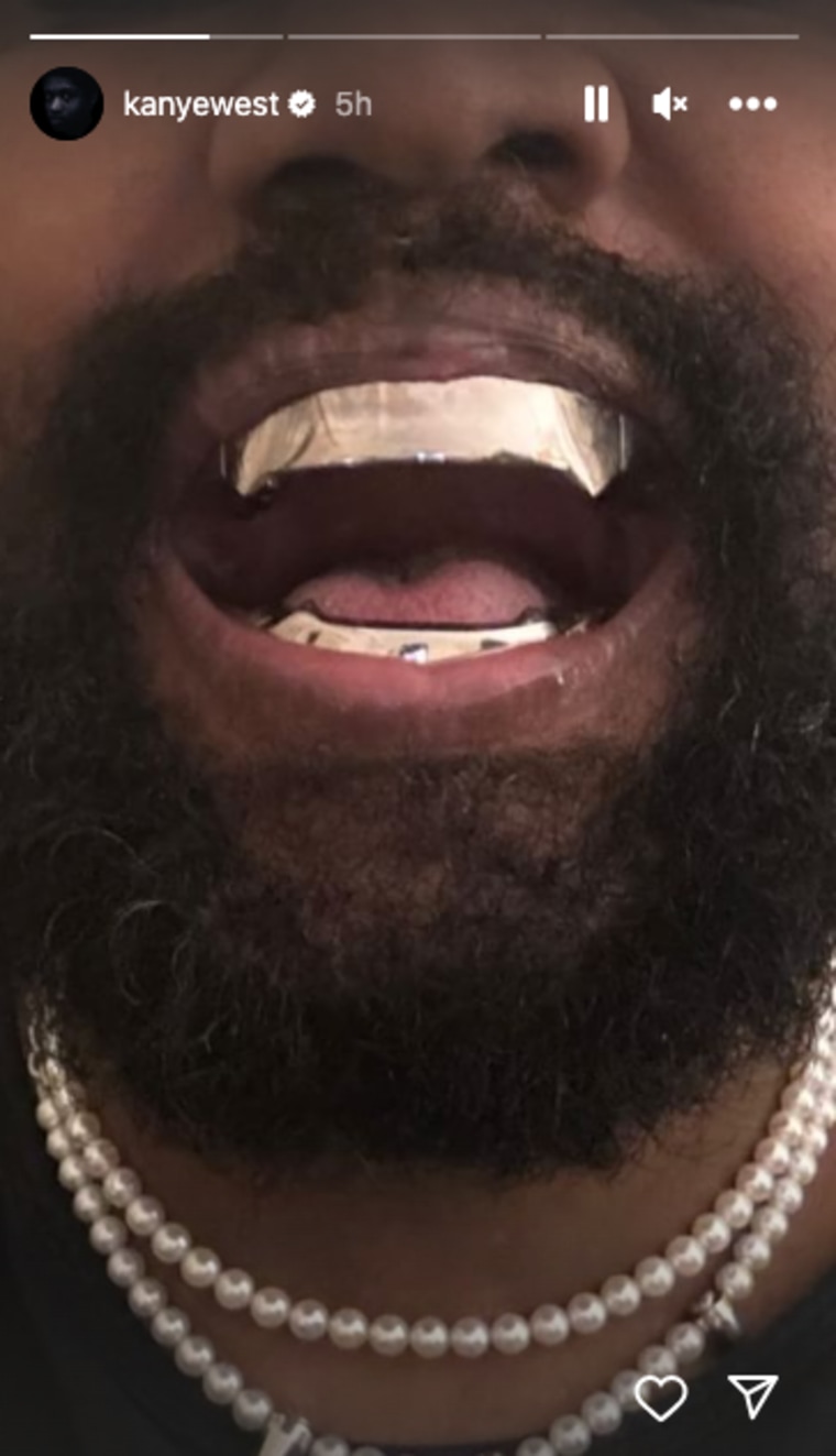 Metallic teeth inside Kanye West's mouth