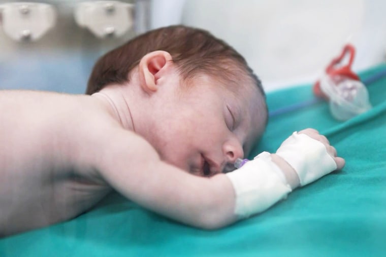 Baby Anas Stateh at Al-Shifa hospital in Gaza