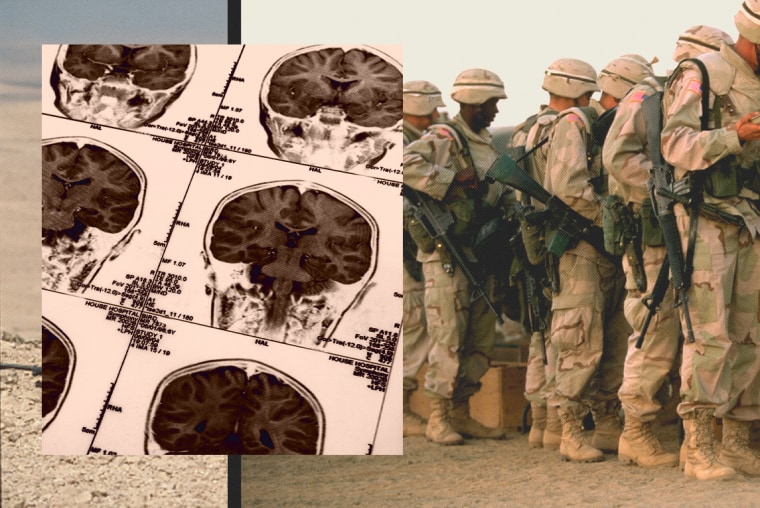 Photo Illustration: Archival images of the U.S. Army and an image of brain scans