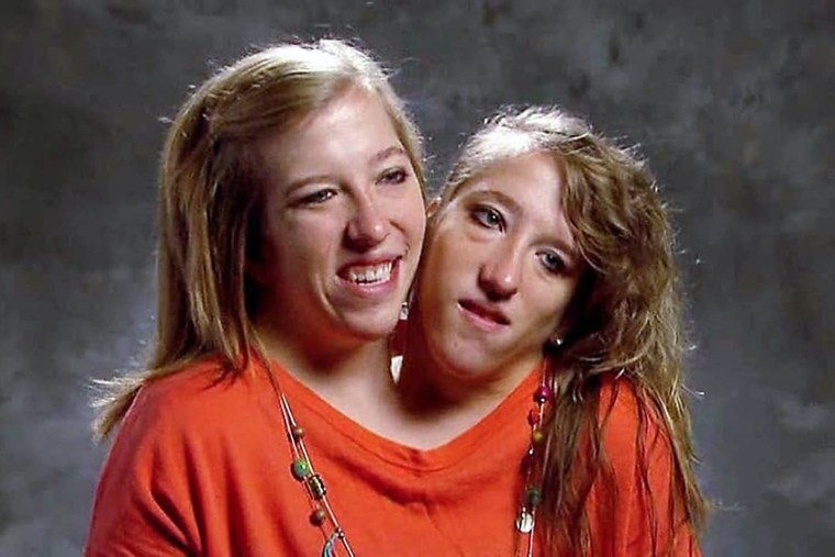 Conjoined twin Abby Hensel is now married