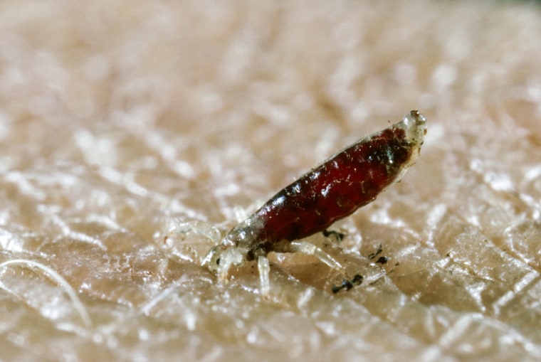 A body louse feeds on human skin