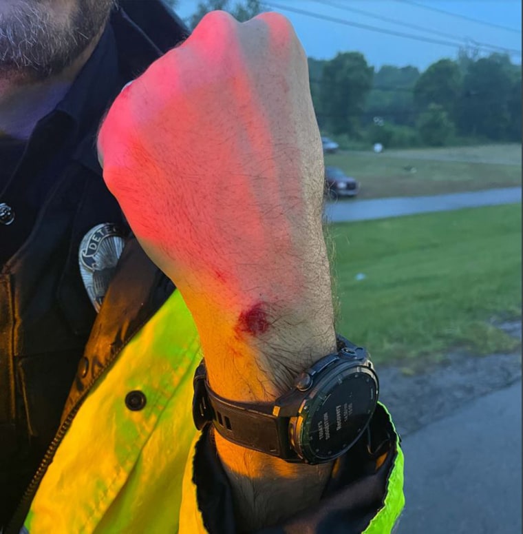 Cut on officer's hand after incident with golf great Scottie Scheffler