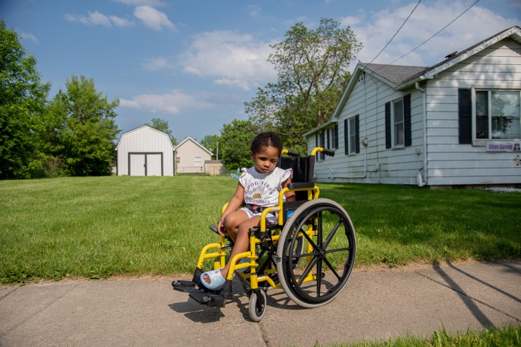 Skye McBride sits in a wheelchair outdoors