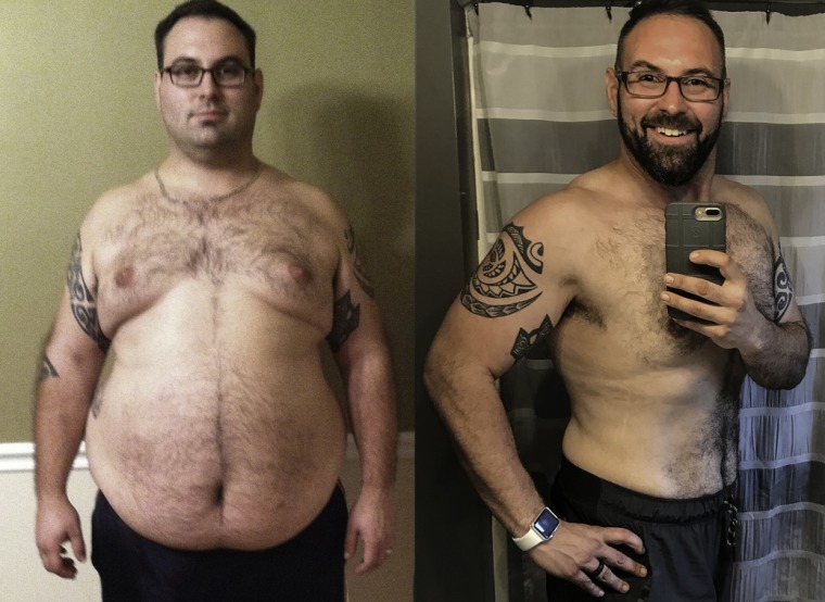 Before an dafter weight loss