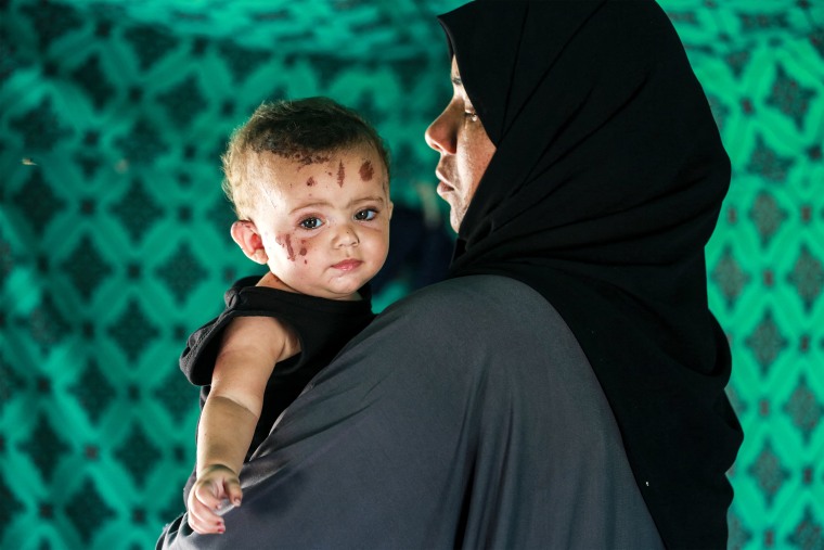 Palestinian toddler Rim Abu Hayya is carried by her aunt Ayat in a tent shelter west of Khan Yunis in the southern Gaza Strip on August 13, 2024.