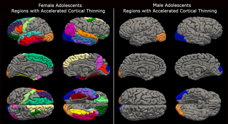 Teenager brains ‘elderly’ all the way through Covid lockdowns, new analysis suggests