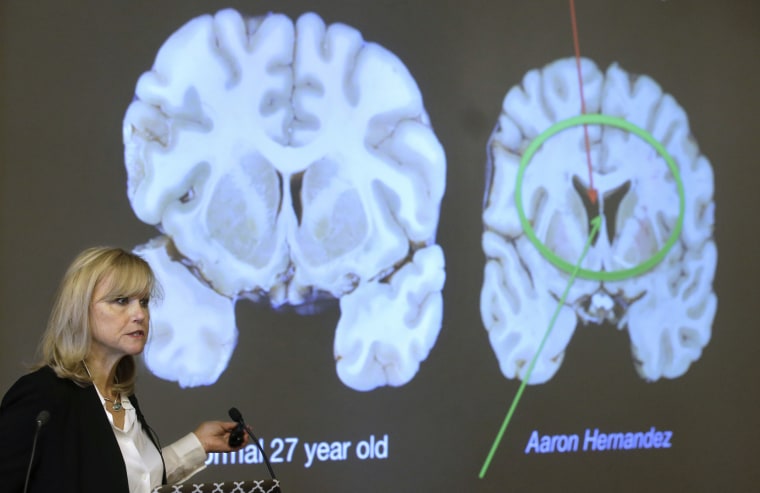 Dr. Ann McKee, director Boston University's center for research into the degenerative brain disease chronic traumatic encephalopathy, or CTE, addresses an audience on the school's campus Thursday, Nov. 9, 2017, about the study of NFL football player Aaron Hernandez's brain. McKee says Hernandez suffered severe damage to parts of the brain that play an important role in memory, impulse control and behavior. The cross section of the brain projected behind left is labeled a normal 27 year old