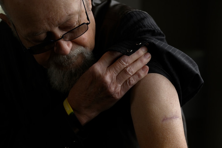 Jim Copenhaver shows his wound