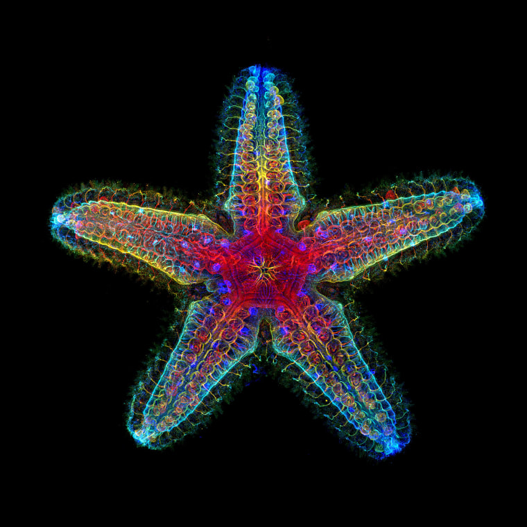 Nervous system of a young sea star.