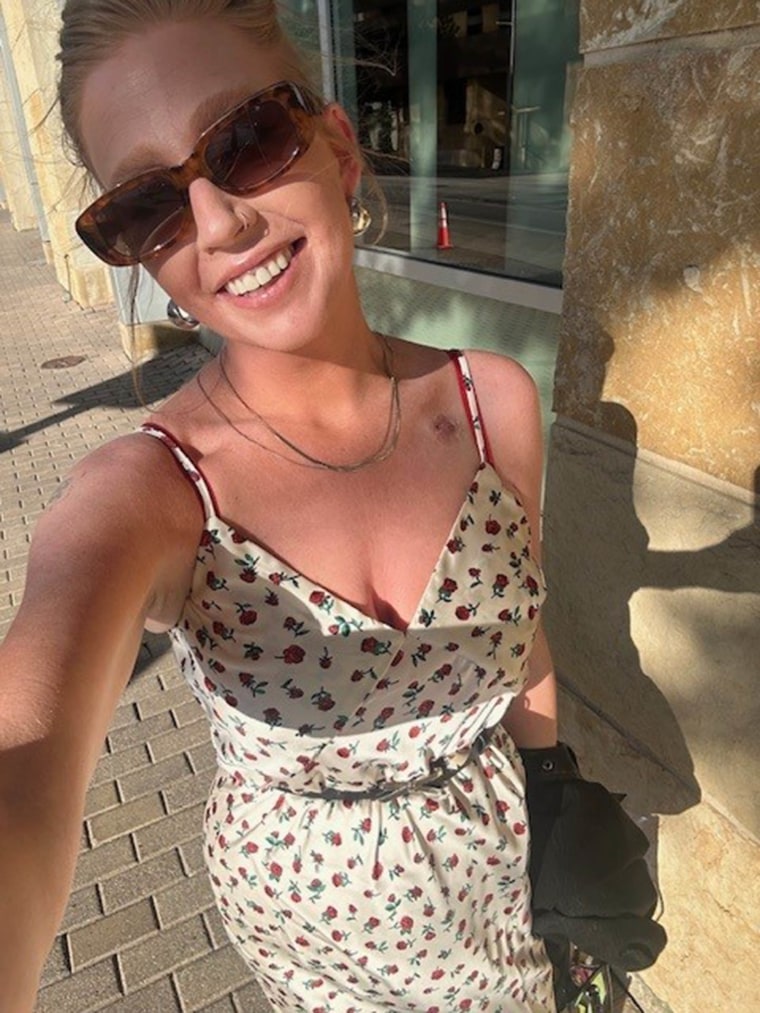 Beth Riehle tongue cancer