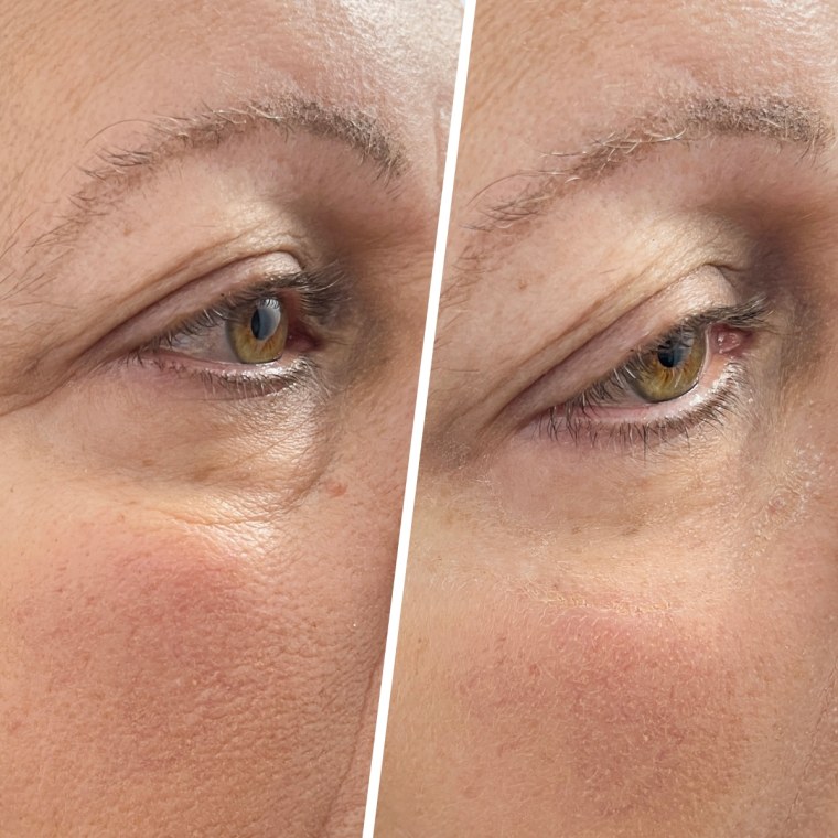Janet Gonzales showing her results after using the Peter Thomas Roth Instant FIRMx Eye Tightener.