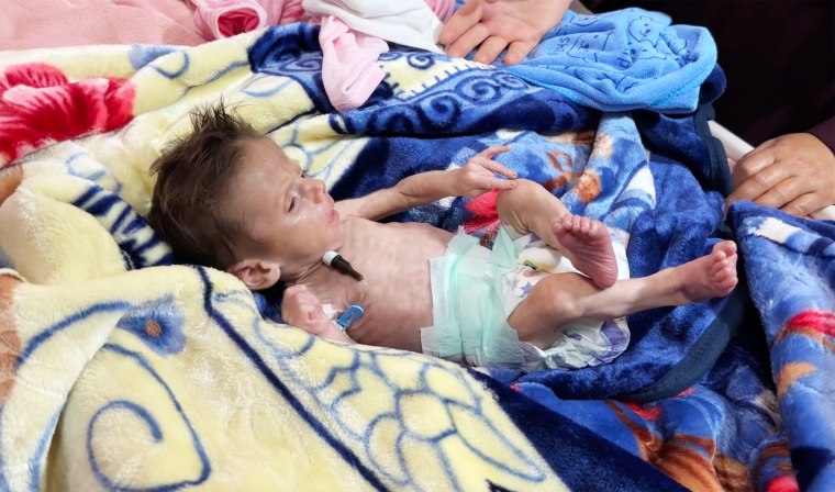 Baby Yussuf Al-Najjar in intensive care at Nasser hospital