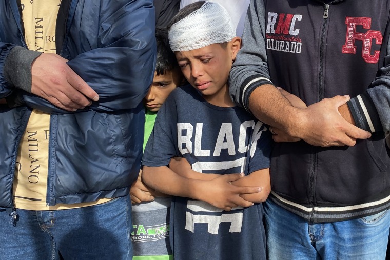 Un niño palestino herido llora.