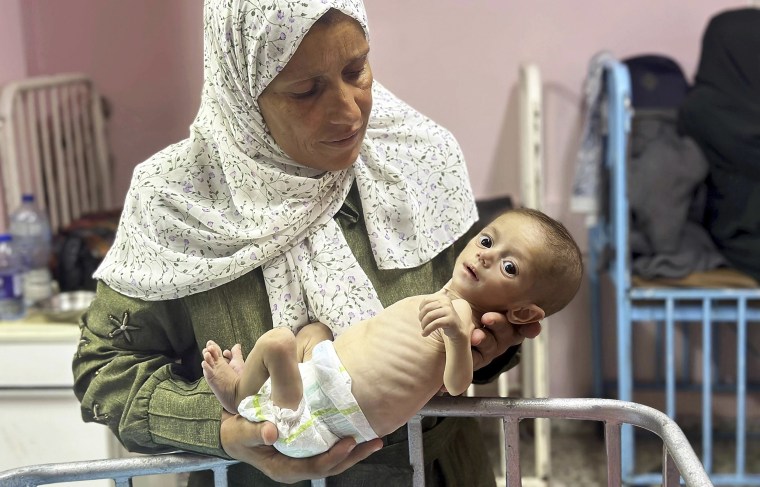 Una abuela acuna un bebé desnutrido de seis meses