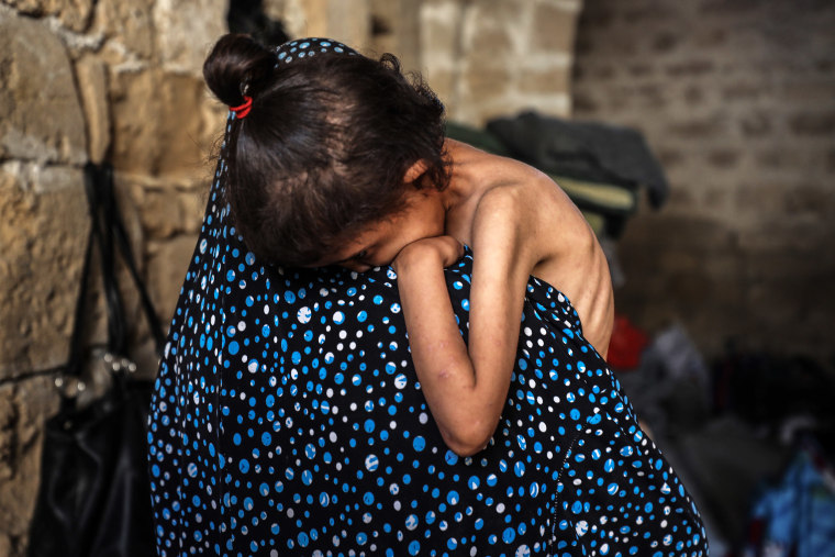 Islam Hajjaj sostiene a su hija de 6 años Najwa, que sufre de desnutrición