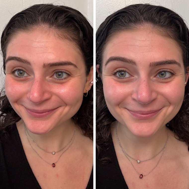 A woman’s face before applying Daybird 4-in-1 Serum Skin Tint, left, and after, right.