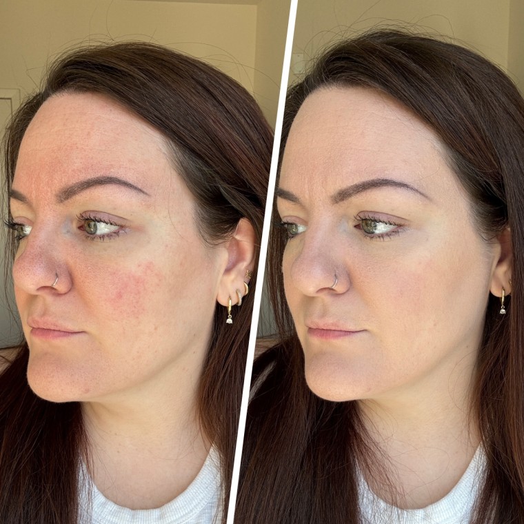 Producer Checka Ciammaichelli before and after applying the It Cosmetics Do It All Radiant Concealer.