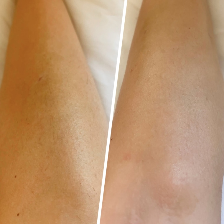 Results before (left) and after (right) using the Nood Flasher for nearly two months.