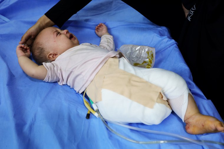 Gazan Child Israeli perde os pés em ataques aéreos