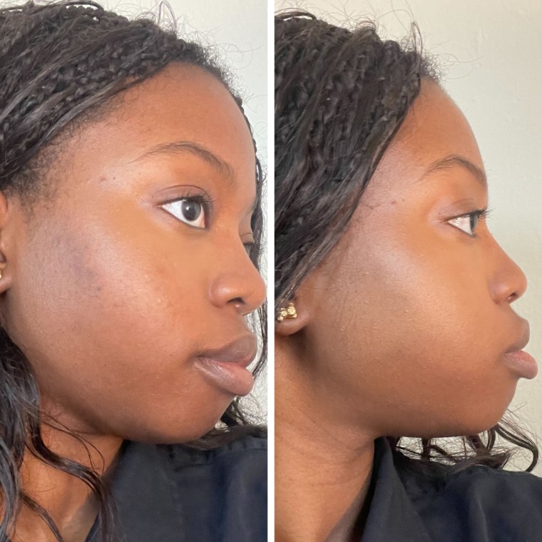 The Maybelline Fit Me concealer perfectly covered up Alabi’s dark spots on her face.